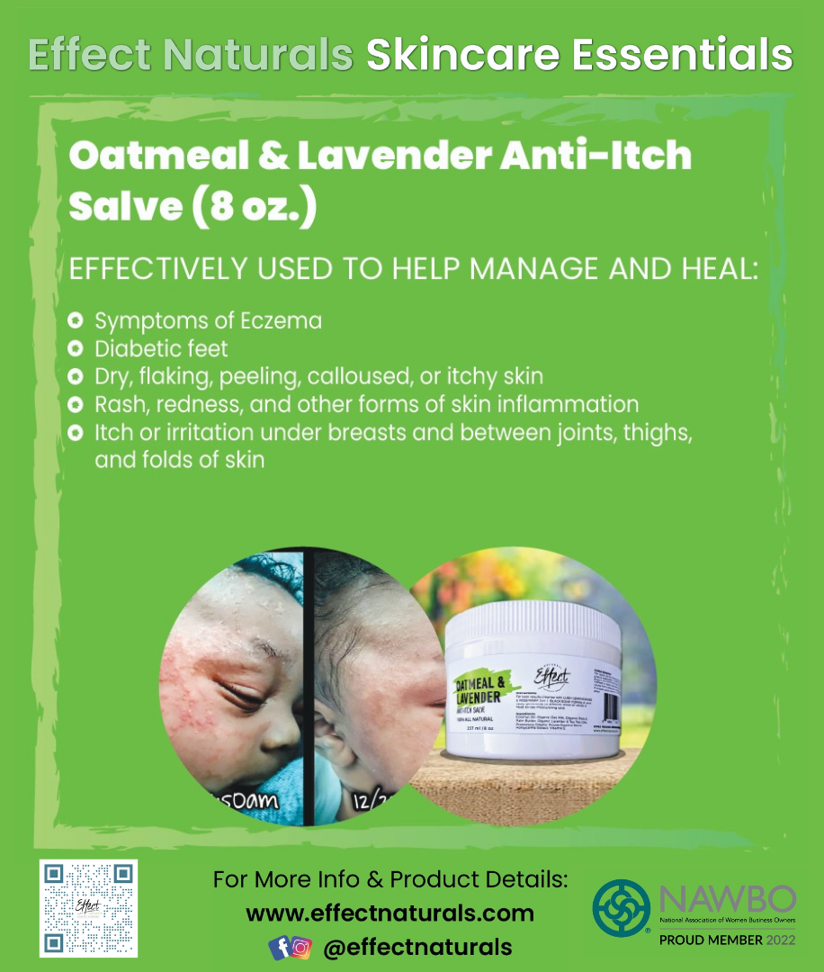 Oatmeal & Lavender All-Purpose Healing & Anti-itch Salve (8 oz.)